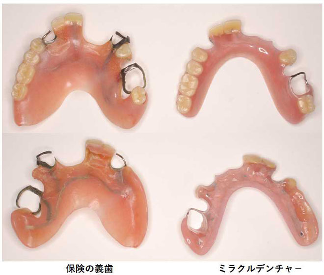 保険のデンチャ－とミラクルデンチャ－