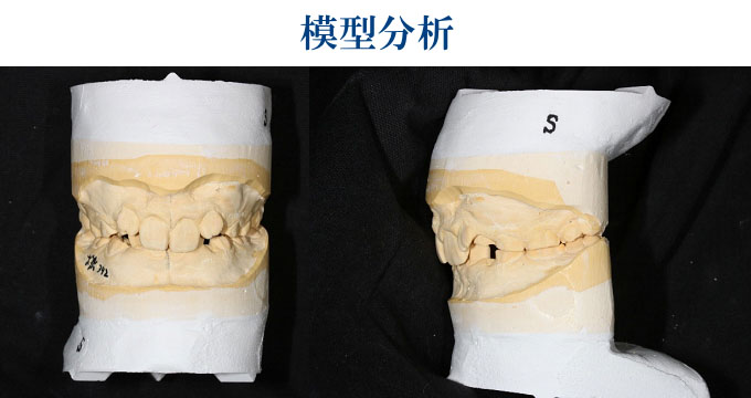 模型分析